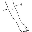 Measuring point:  Circumference of elbow joint  